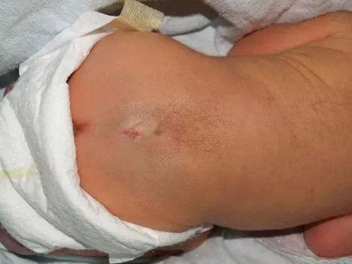 屁股洞照片,探寻人体奥秘的视觉之旅