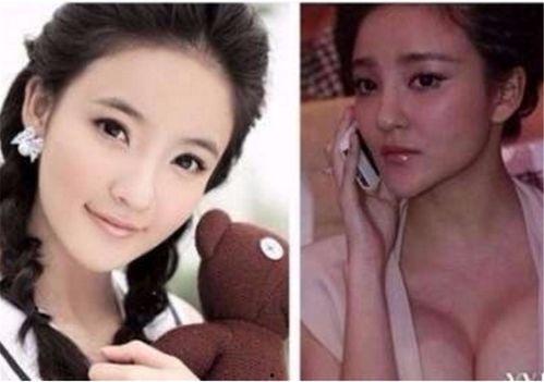 那些整容失败的女明星,那些曾美艳动人却败在手术刀下的女明星